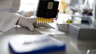 Test da HIV.