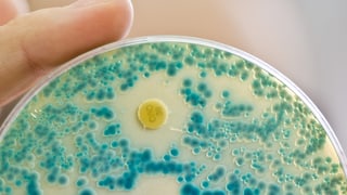 Bacterias en vaider da reagenza. 
