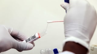Mauns da medi che mettan il bastunin da test en il vaiderin.