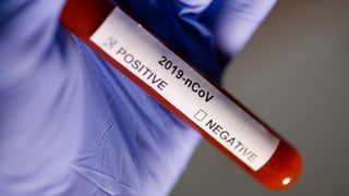 In’ampulla da test cun l’etichetta per il virus da corona.