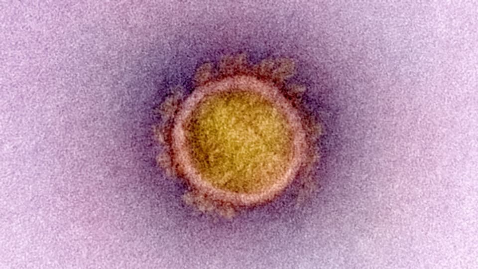 Virus da corona.