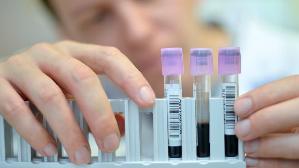 Labor d’antidoping svizra a Losanna.