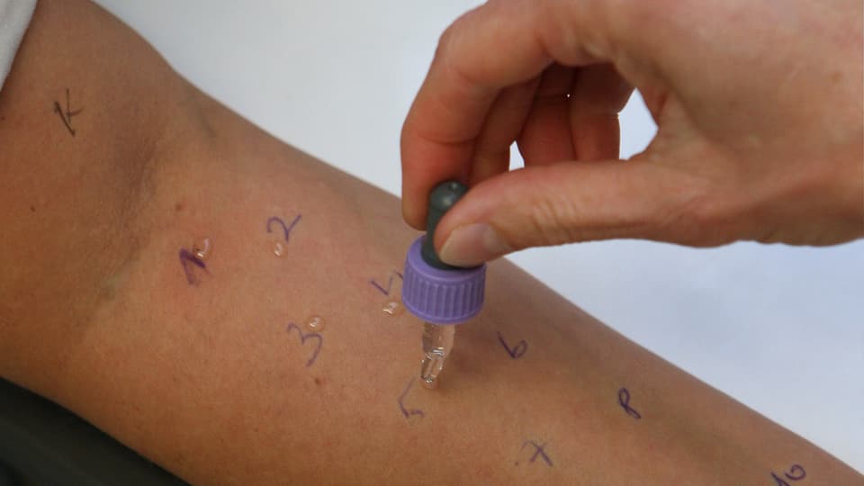 In bratsch cun scrit si pliras cifras ed in maun d'in medi che fa il test d'allergias.