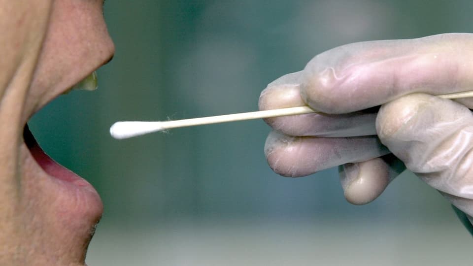 Persuna ch'avra la bucca per laschar prender ina prova da la DNA.