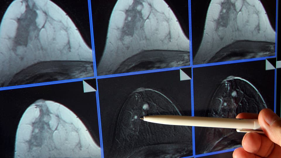 maletgs da radiografia d'in sain