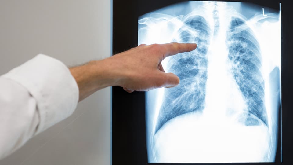 In maun dad in medi mussa sin in maletg da radiografia.