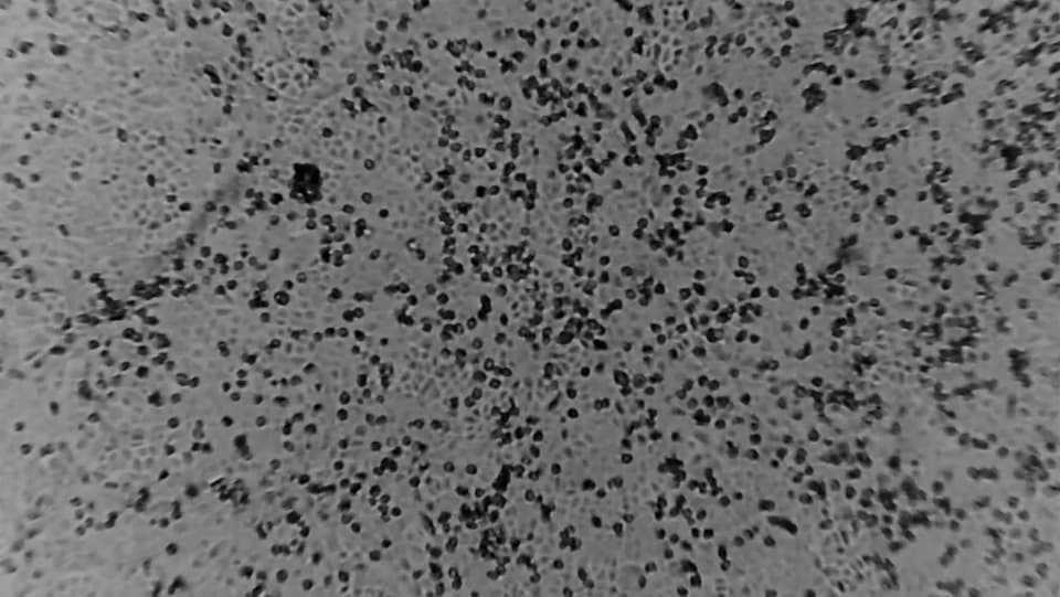 Purtret da punctins nairs sin in funs grisch – il virus da corona reproducì en ina stgadiala dal labor.
