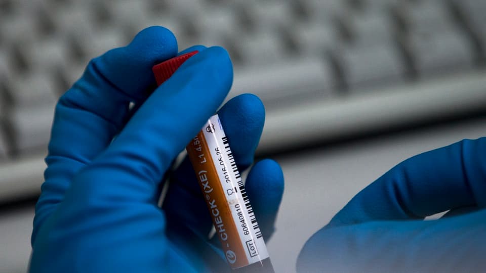 Ina da las provas da sang che vegn evaluada sch’il sportist ha duvrà doping.